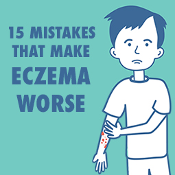 15 Mistakes That Make Eczema Worse