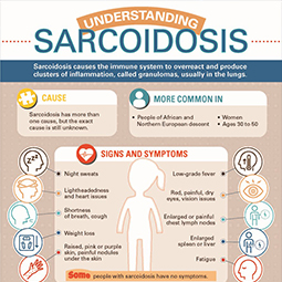 Understanding Sarcoidosis